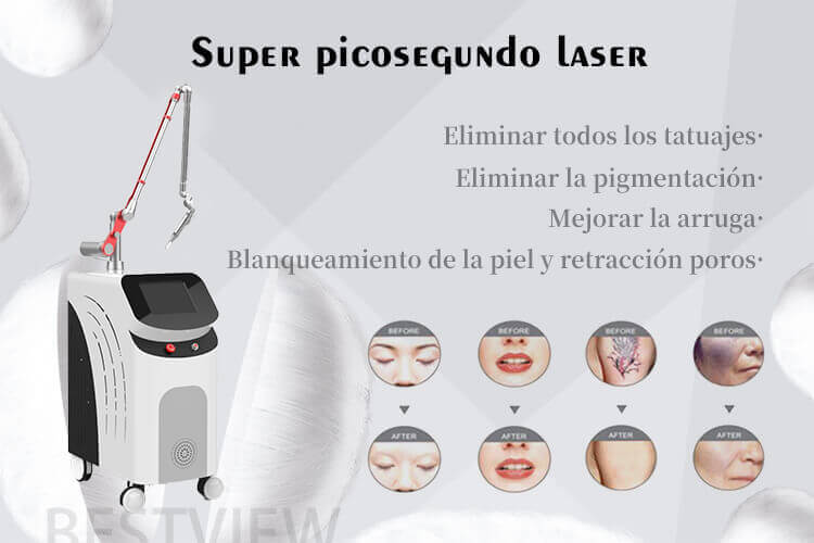 maquina laser para remover tatuajes