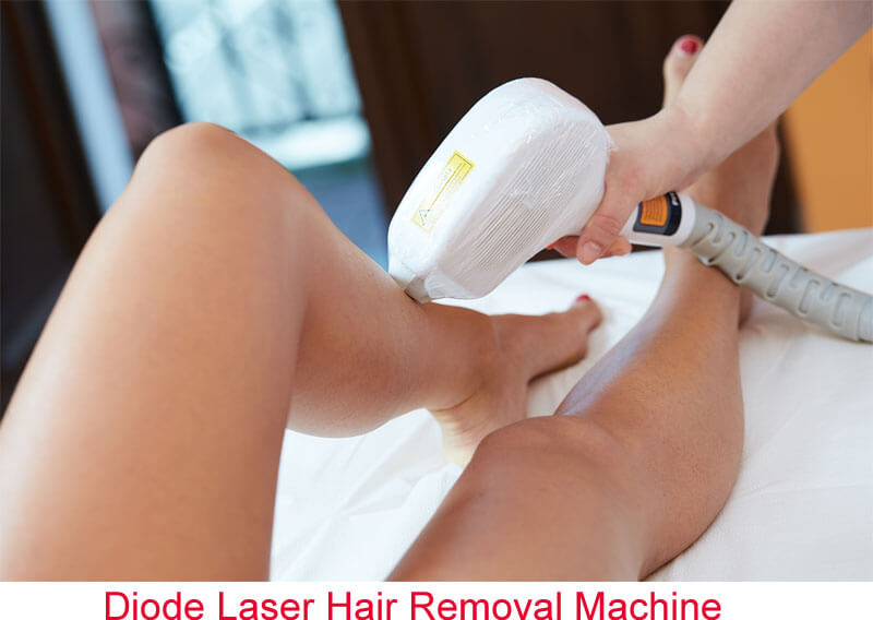 diode laser permanent hair removal machine