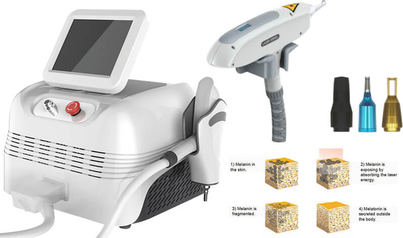 best q switched nd yag laser