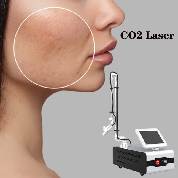 Gama de tratamiento facial con láser CO2 fraccionado