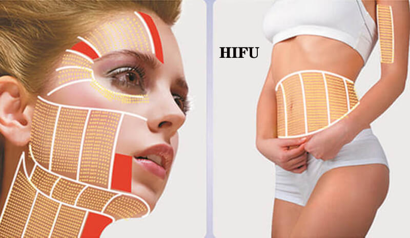 hifu beauty machine