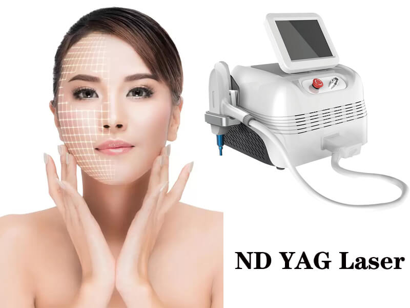 best nd yag laser machine