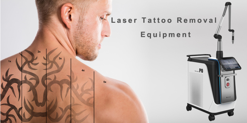 laser tattoo removal machine