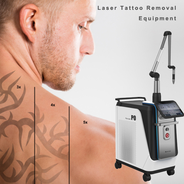 La elección de la mejor láser para eliminar tatuajes máquina