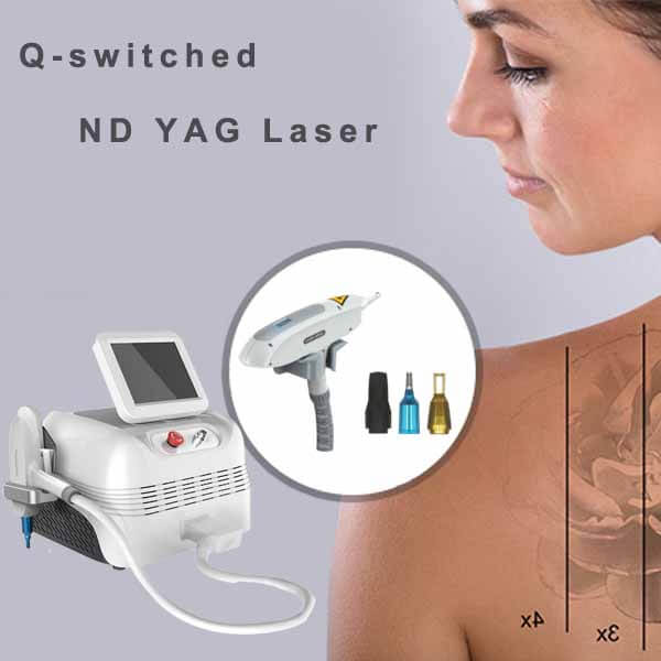 ¿Cómo se pueden minimizar los efectos secundarios del tratamiento con láser ND YAG?