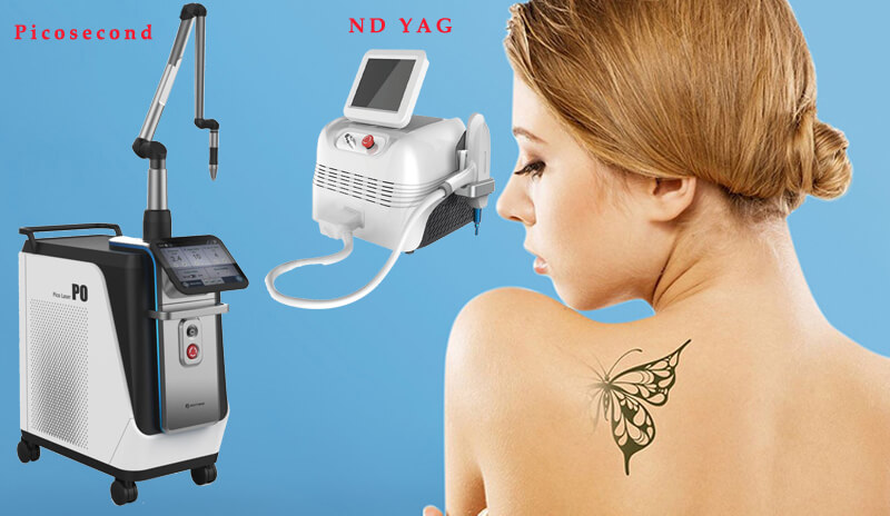 professional laser tattoo removal machine