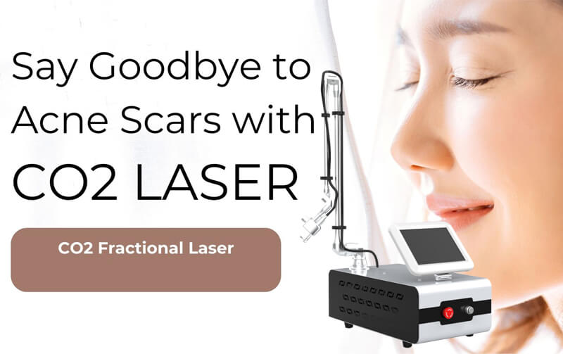co2 fractional laser machine for scar removal