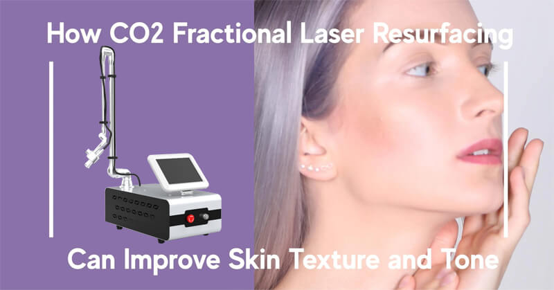 co2 fractional laser machine supplier