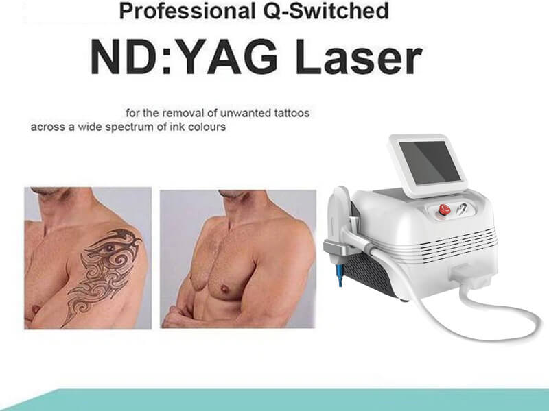 Q-switched ND YAG laser machine