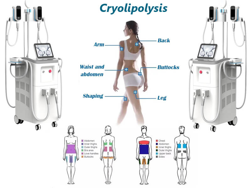 cryolipolysis fat freezing machine