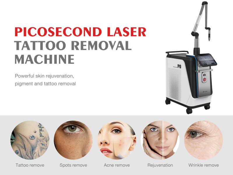 picosecond laser machine