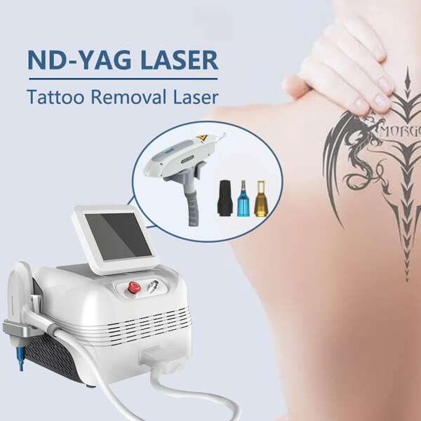 Conozca la tecnología laser ND YAG Q switched que elimina los tatuajes