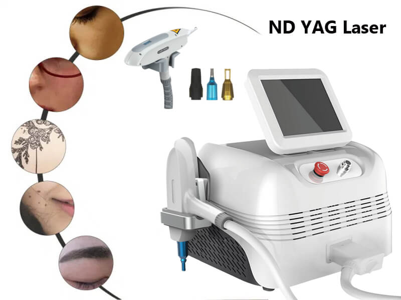 q-switched nd yag laser tattoo removal machine