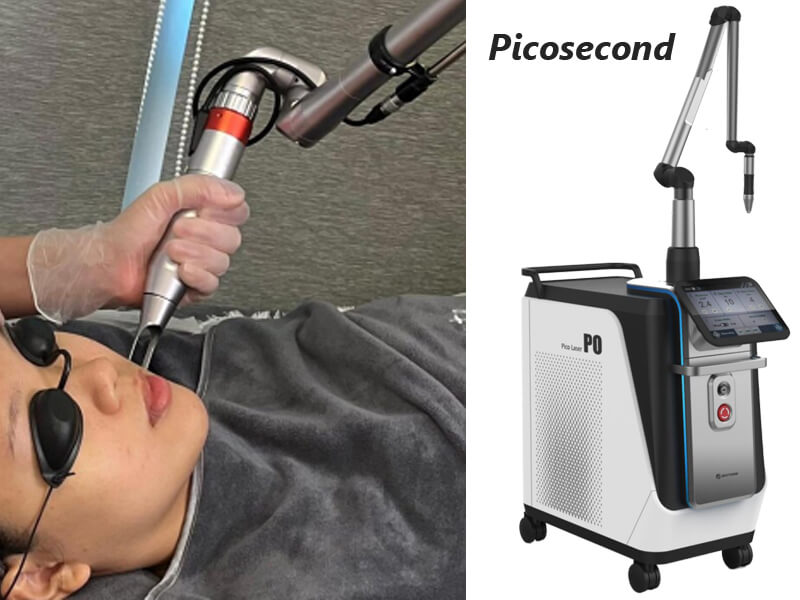 picosecond laser machine