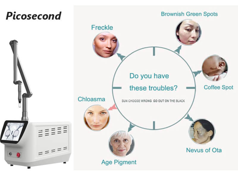 picosecond laser machine