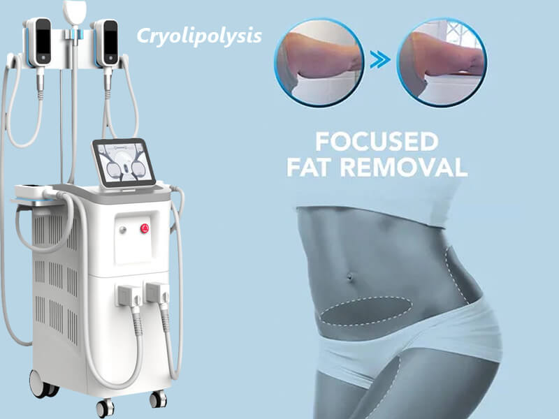 cryolipolysis fat freezing machine