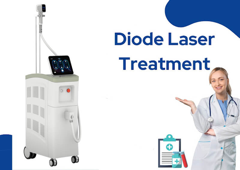 diode laser hair removal machine