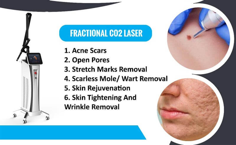 co2 fractional laser machine