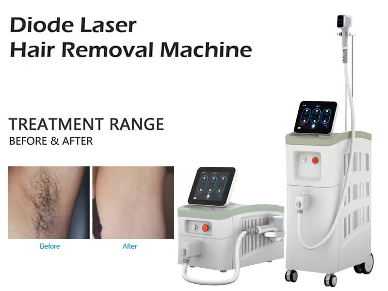 diode laser hair removal machine