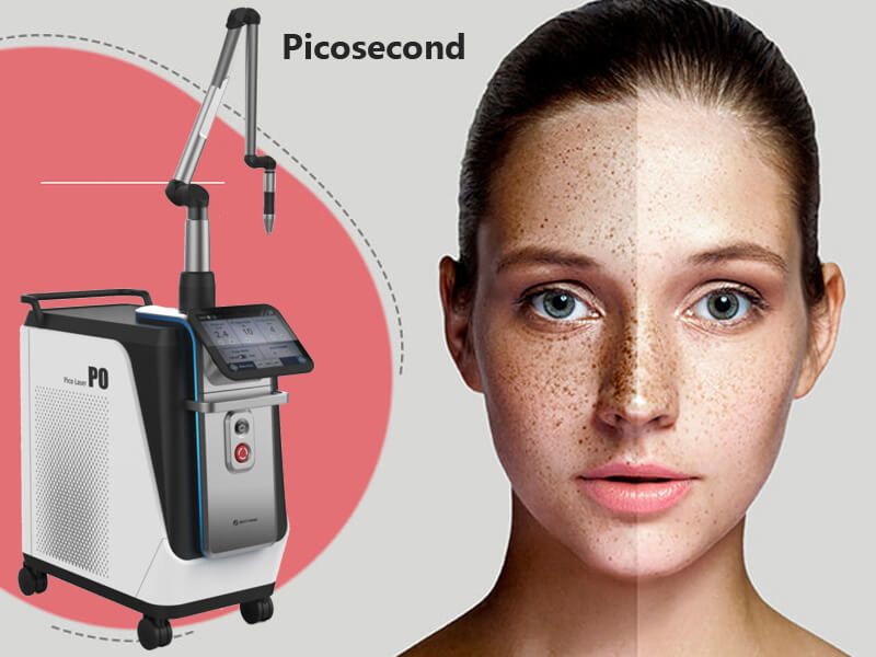 picosecond laser machine