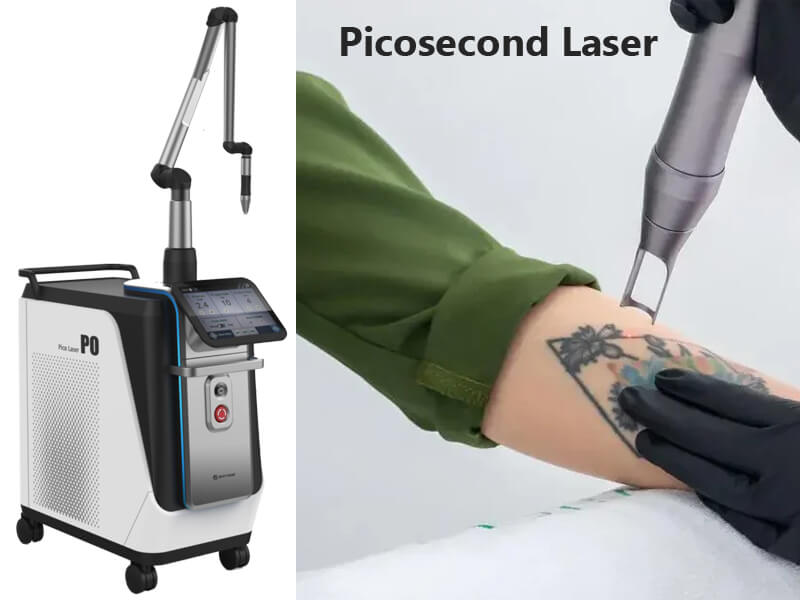 picosecond laser machine