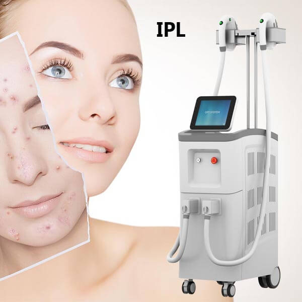 Qué esperar antes, durante y después del tratamiento fotofacial IPL