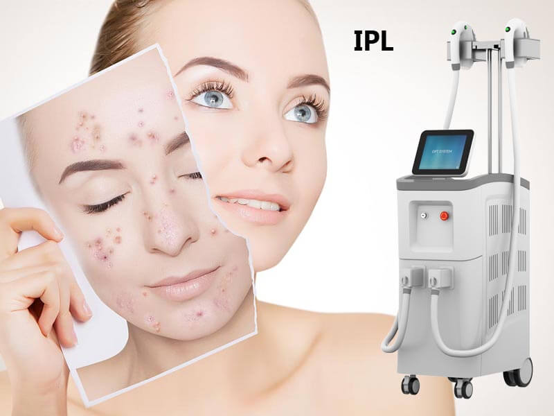 professional ipl machine