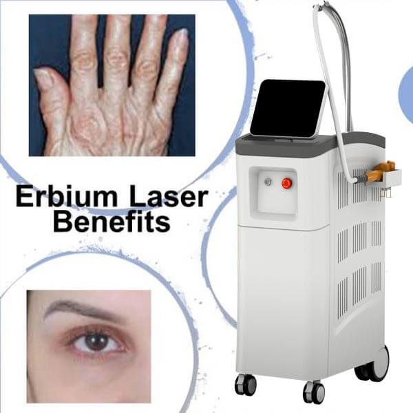 Buen candidato para el erbium laser resurfacing