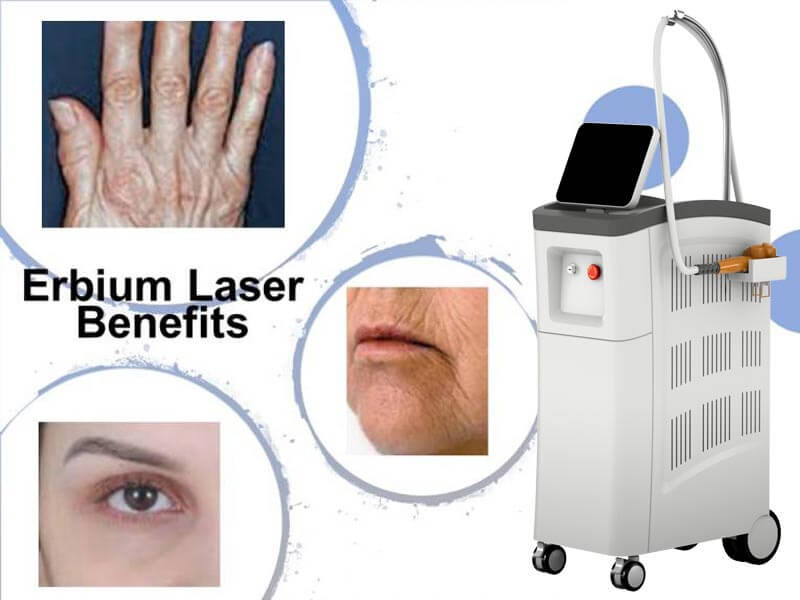 erbium laser machine