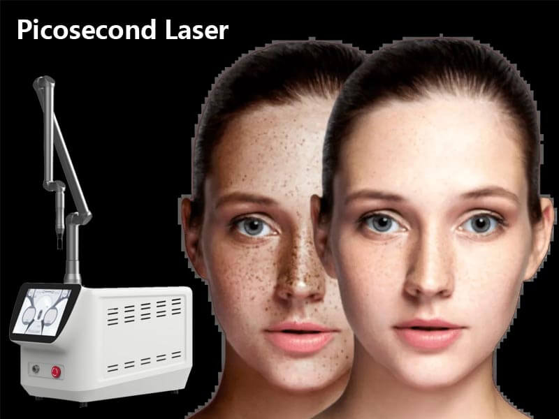 picosecond laser machine