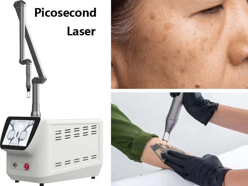 picosecond laser machine