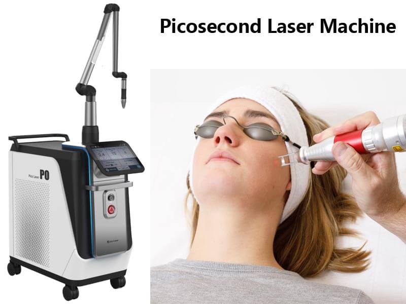 picosecond laser machine