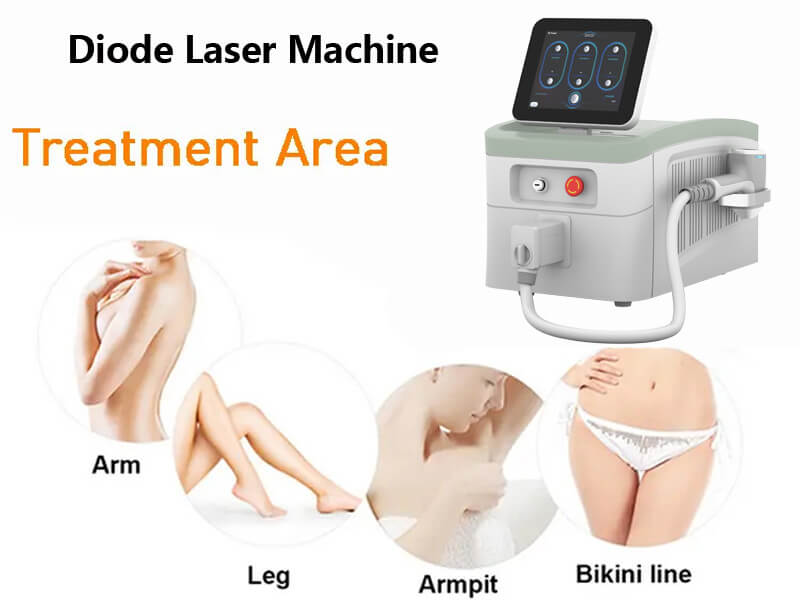 diode laser hair removal machine