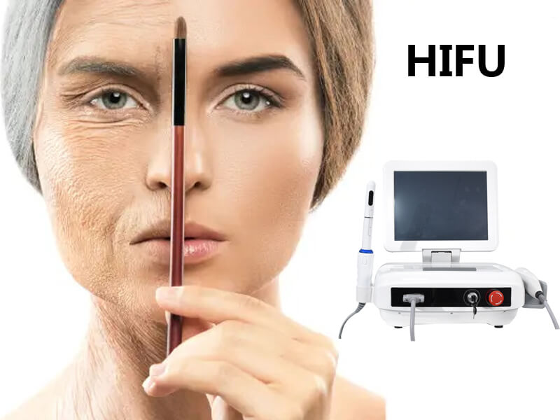 hifu skin tightening machine