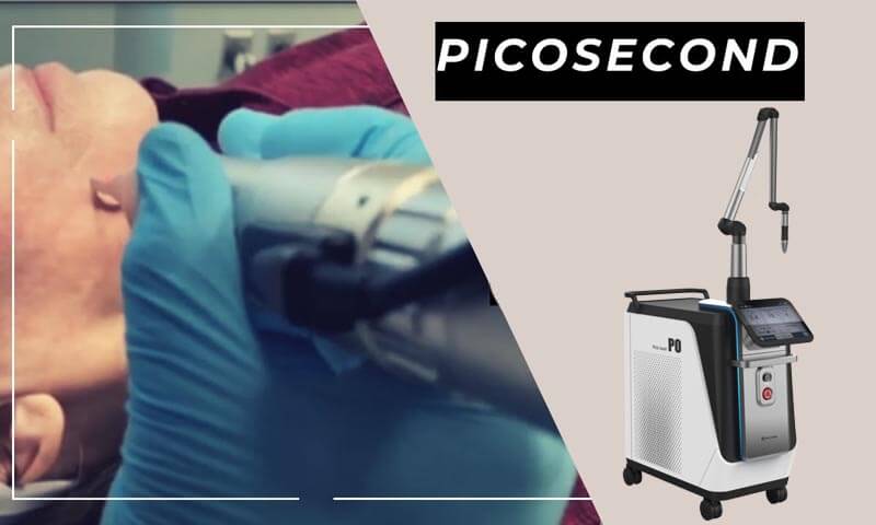 picosecond laser machine