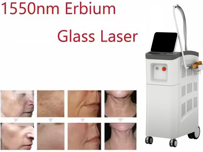 erbium laser machine