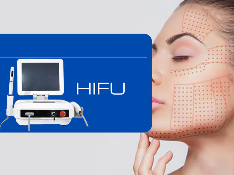 hifu ultrasound machine