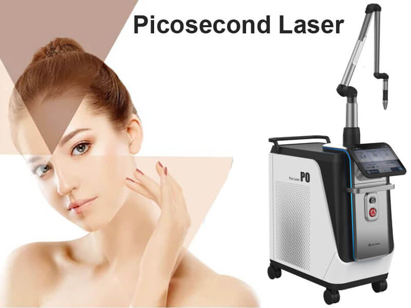 picosecond laser tattoo removal machine