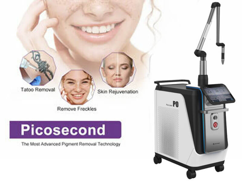 picosecond laser tattoo removal machine