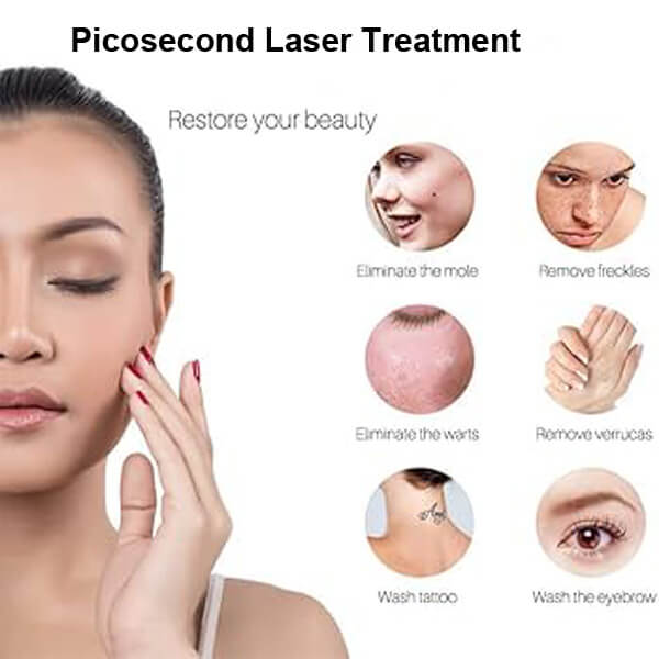 picosecond laser machine