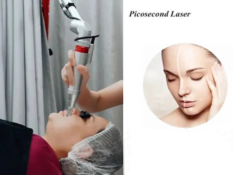 picosecond laser machine