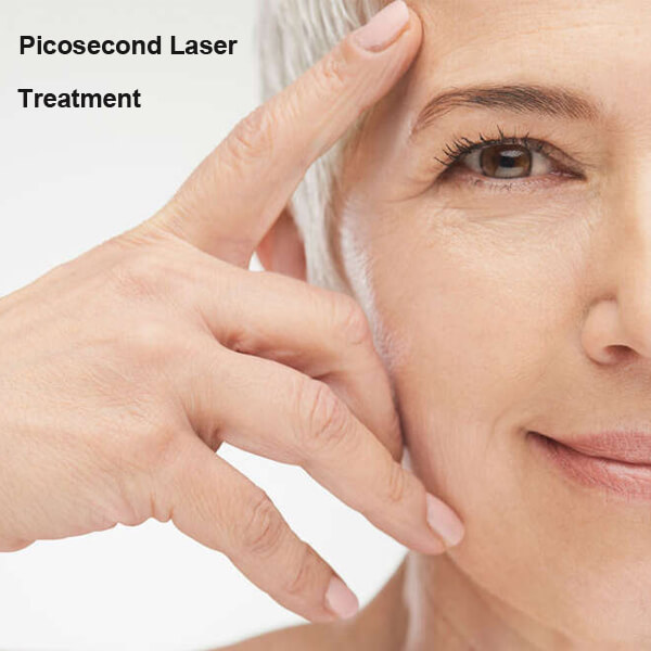 picosecond laser machine