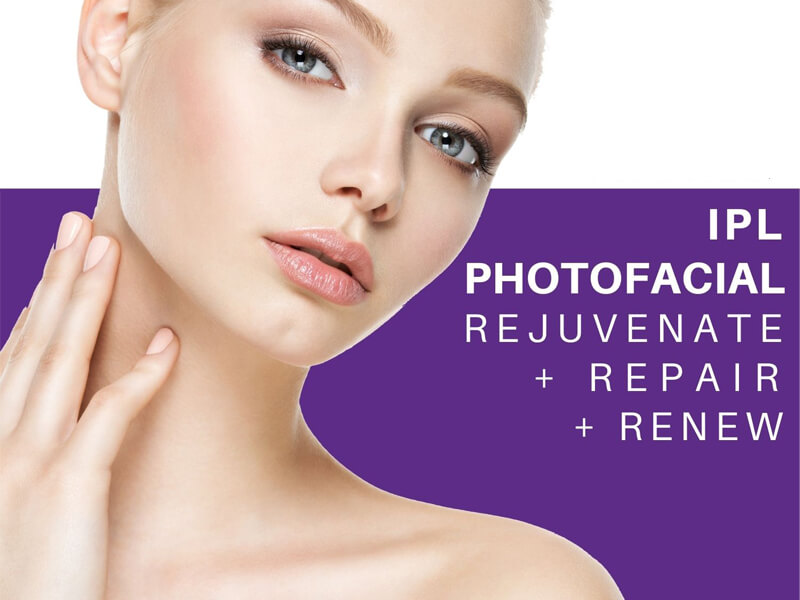 ipl photofacial machine