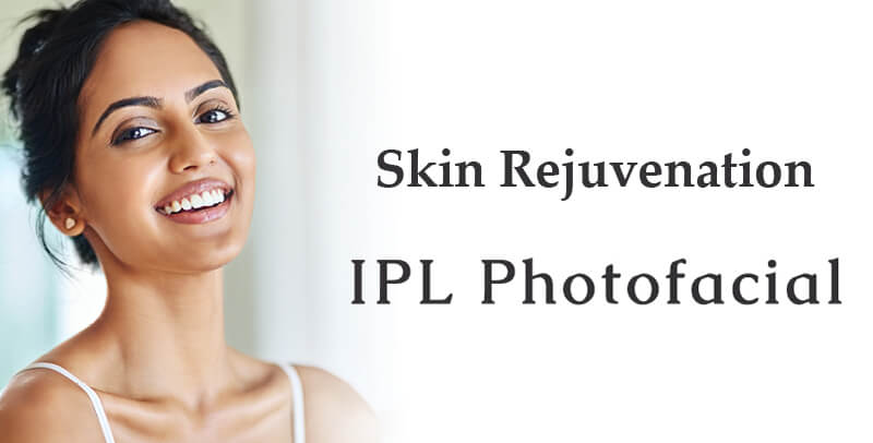 ipl photofacial machine
