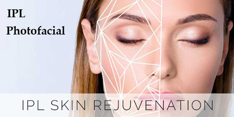 ipl skin rejuvenation machine