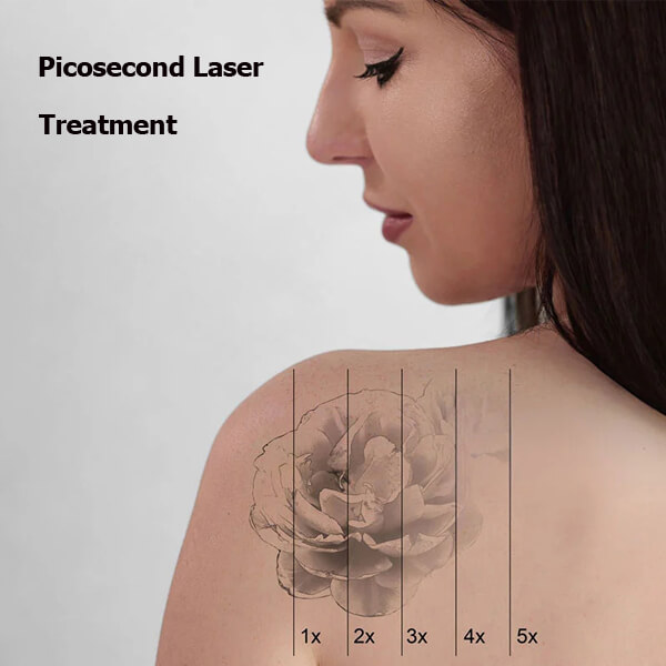 picosecond laser machine