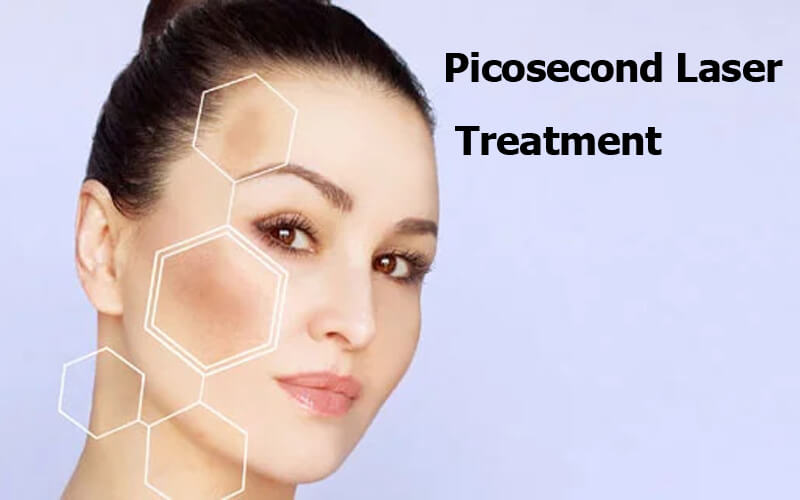picosecond laser machine