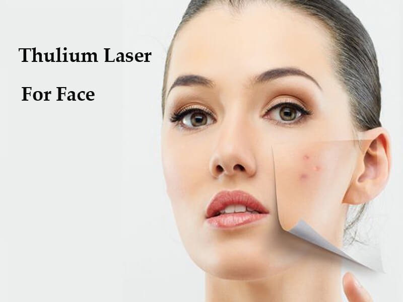 thulium laser for face