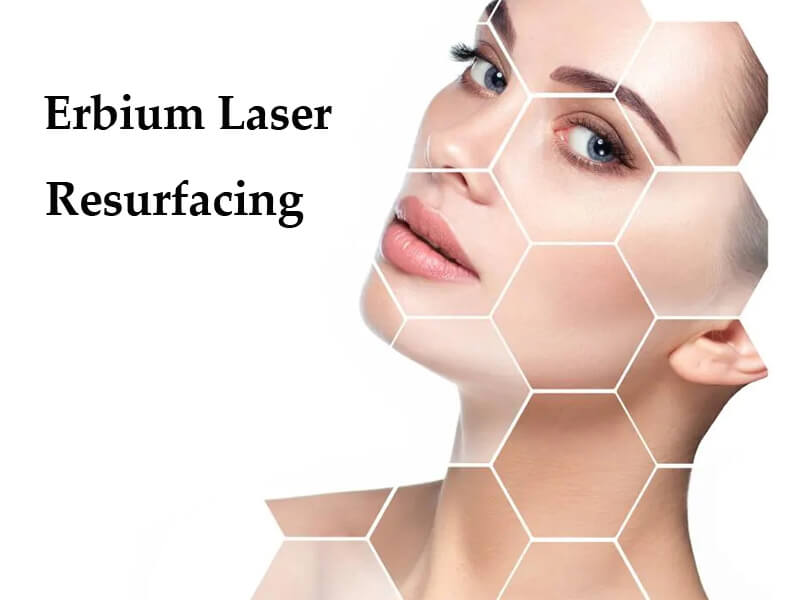erbium laser resurfacing