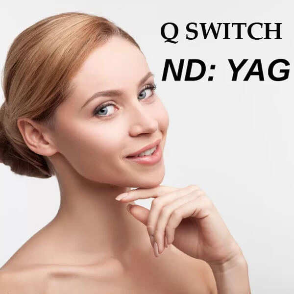best nd yag laser machine